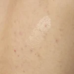 Salicylic Acid 0.5% Body Serum - Image 3